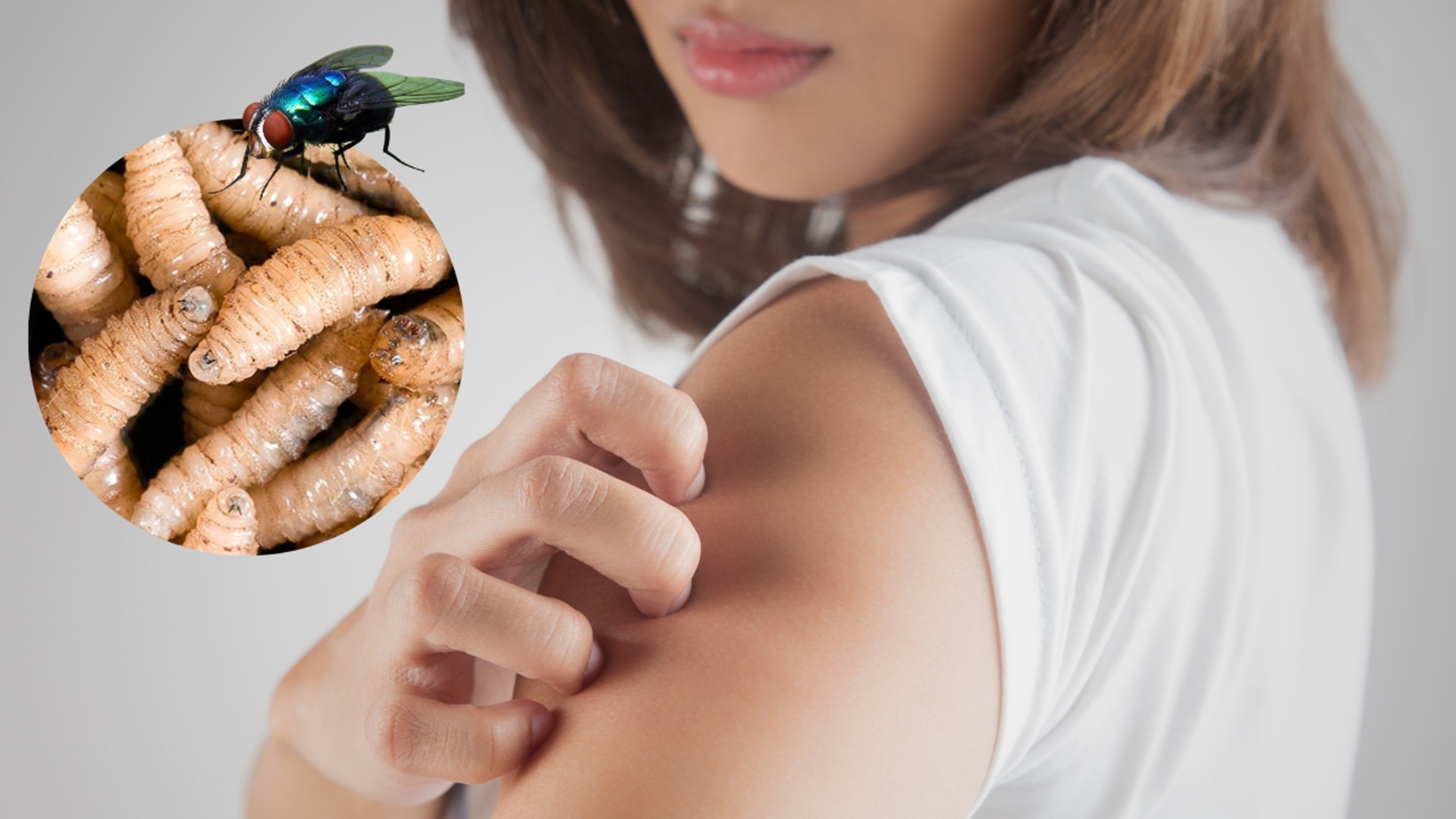 Muere adulto mayor en Oaxaca con miasis por gusano barrenador; SSO descarta riesgo para la población