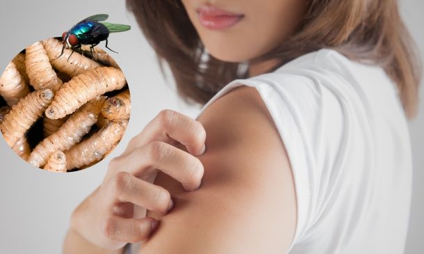 Muere adulto mayor en Oaxaca con miasis por gusano barrenador; SSO descarta riesgo para la población