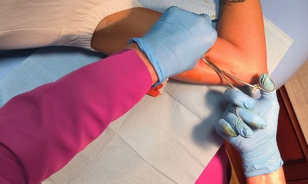 Servicios de Salud de Oaxaca realizará en Istmo de Tehuantepec jornadas gratuitas de implantes subdérmicos